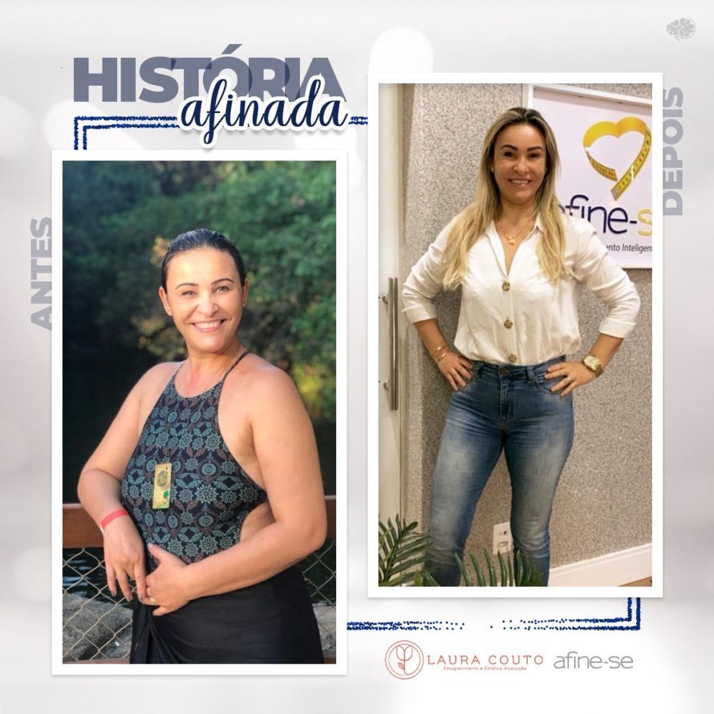 antes e depois de mulher que perdeu 19kg